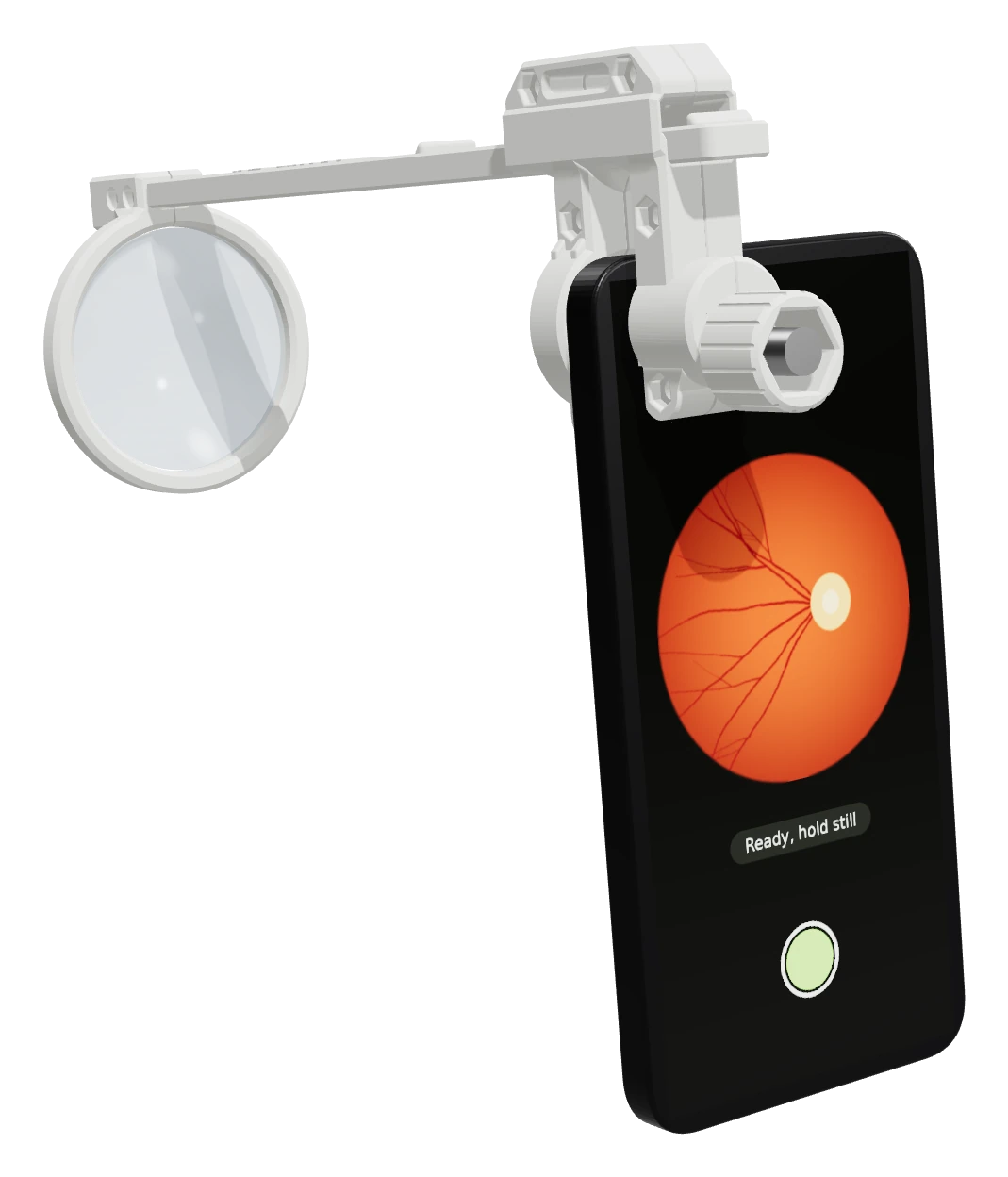 NeuroPix retinal attachment prototype mounted on a smartphone